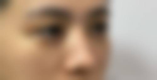 西安众山臻美医疗美容门诊部怎么样价格收费