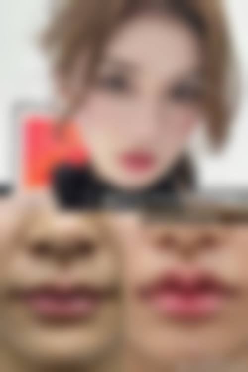 武汉汉星整形医院怎么样价格收费