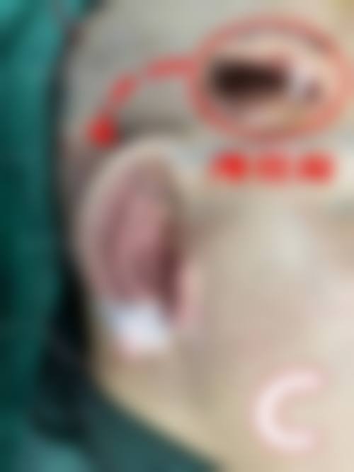 武汉汉星整形医院怎么样来院路线