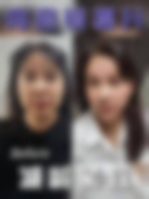 南宁瑞柏美医疗美容门诊部怎么样求美者反馈