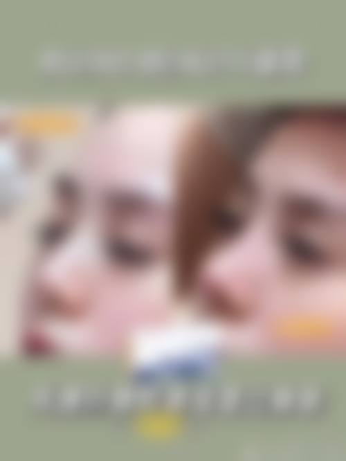 林珣珣医生的特色实例