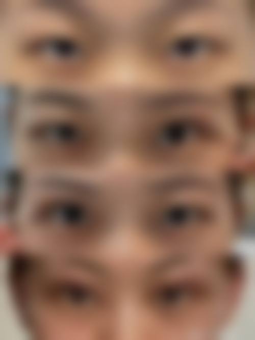 合肥美昱整形医院怎么样求美者反馈