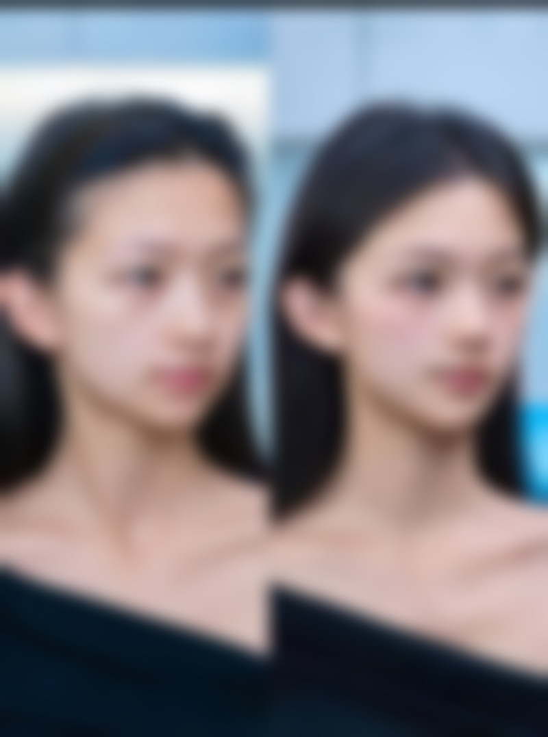 北京紫会所整形医院怎么样医生团队实力