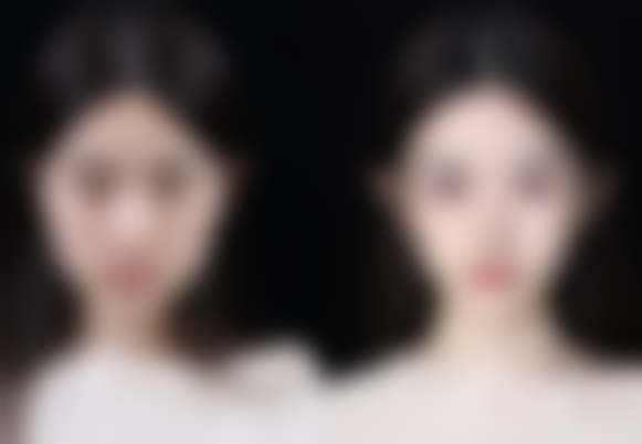 青叶Clinic 千叶怎么样特色项目及技术优势