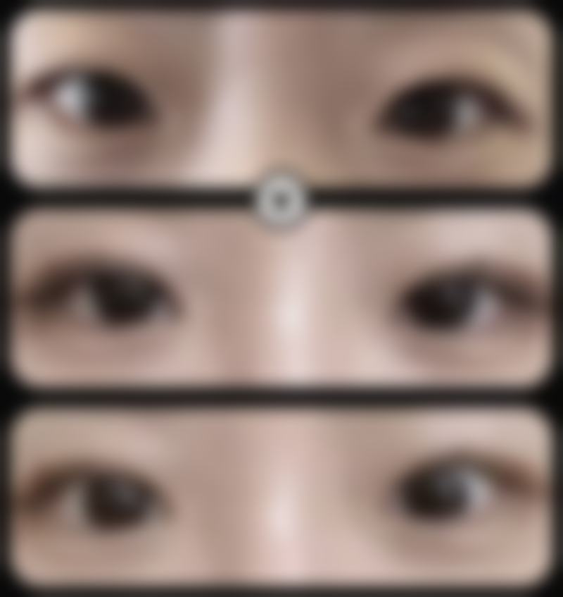 长春亚韩医学美容医院怎么样求美者反馈