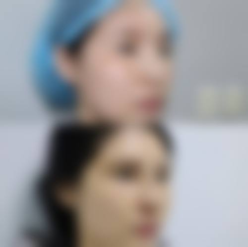 丁娓娓医生的成功实例见证实力