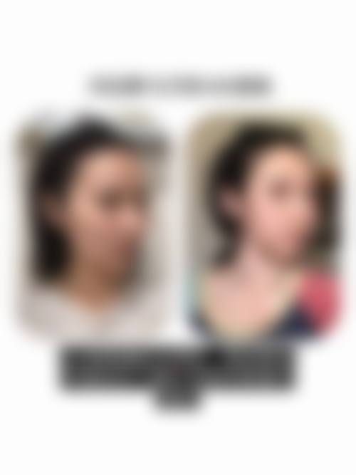 河南中医药大学第一附属医院整形科怎么样来院路线