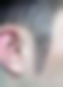 周启明医生的植发价格范围