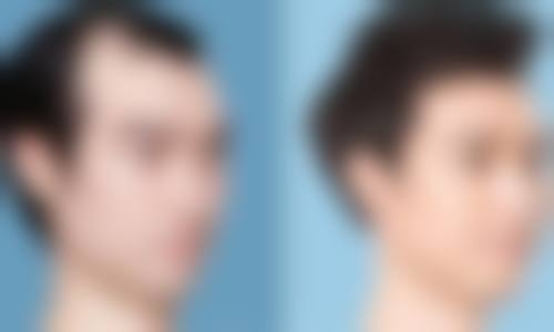 周启明医生助力患者重获自信