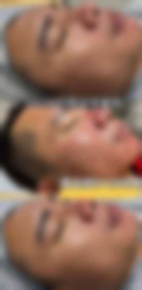 湖州九八医院怎么样求美者反馈