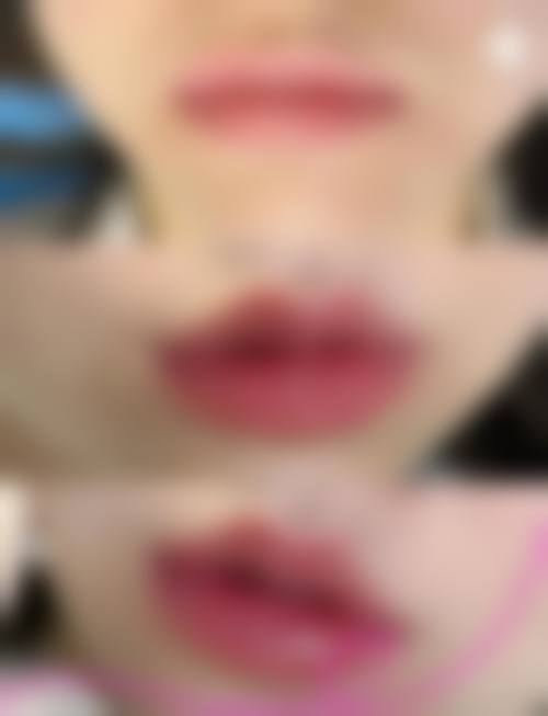 金娟医生：依托精良设备保护手术安心