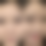 杨军民擅长的医美领域