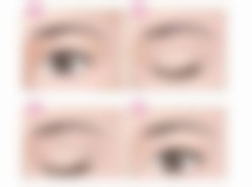 李芸医生的特色技术