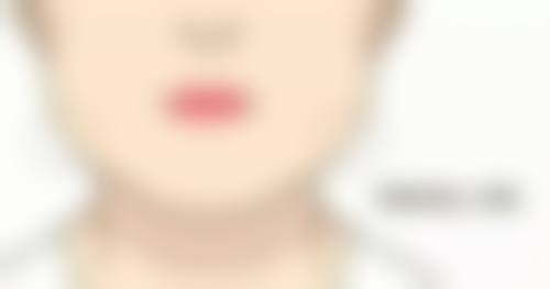 河南汇星医疗美容整形怎么样特色项目及技术优势