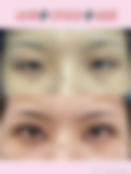 赵绛波医生的个性化医美服务