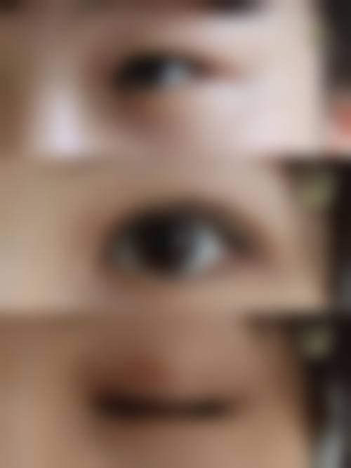 韩国BornDi整形外科怎么样特色项目及技术优势