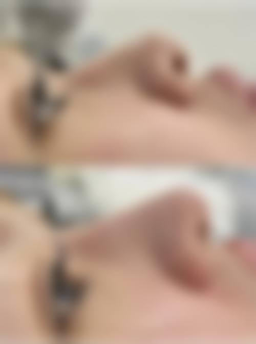 赵绛波医生的擅长整形技术