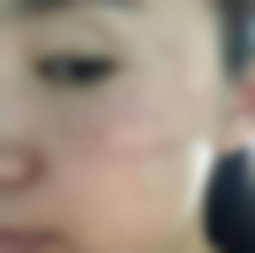 深圳颐和门诊部皮肤美容科怎么样医生团队实力