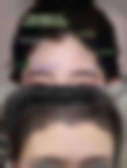 河南育发植发研究院怎么样来院路线