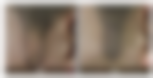 河南育发植发研究院怎么样求美者反馈