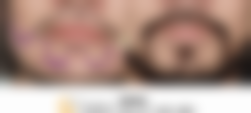 河南育发植发研究院怎么样特色项目及技术优势