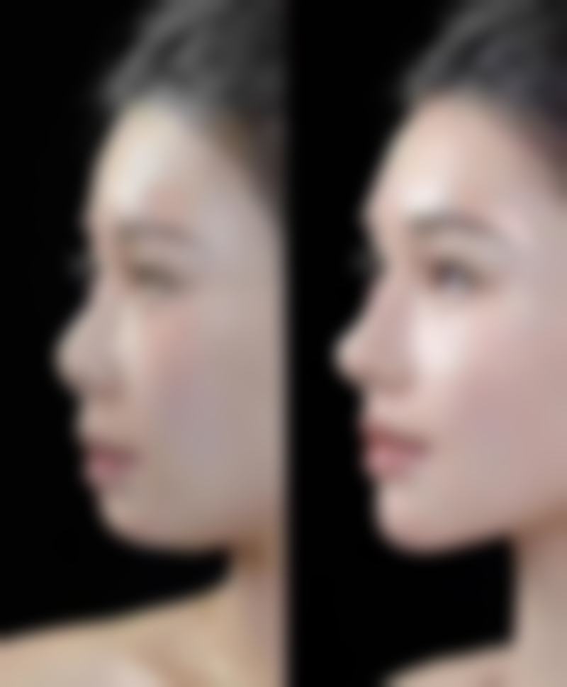 龚小俊医生的个性化方案