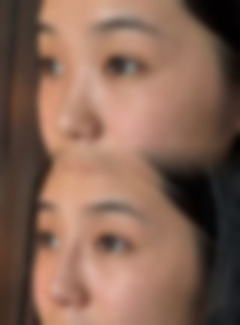 韩国BornDi整形外科怎么样求美者反馈