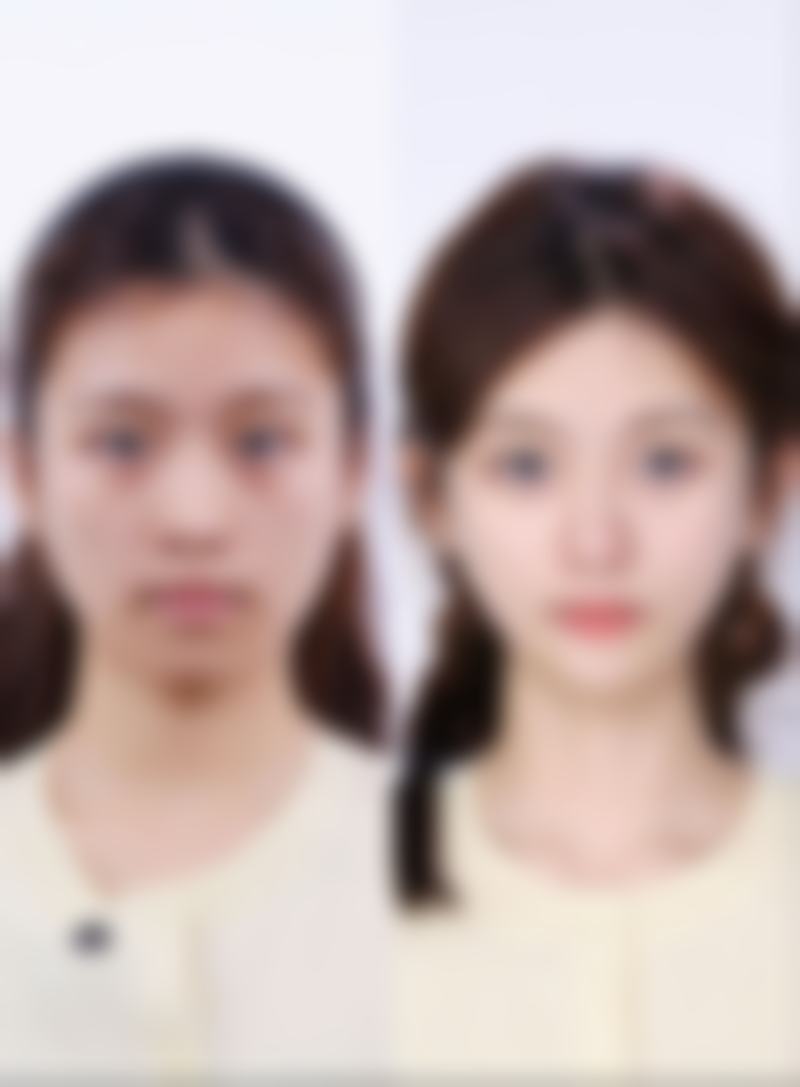 戚振医生的专精实力保护