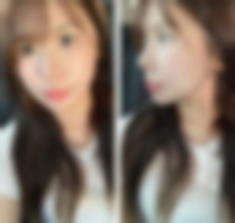 戚振医生助力美丽梦想