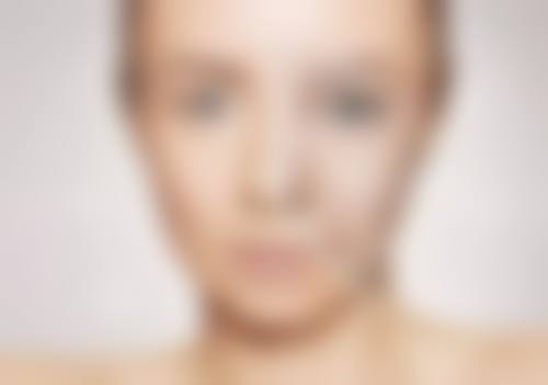 深圳晟丽瀞一博颜整形医院怎么样求美者反馈