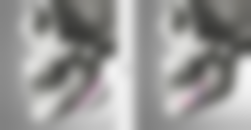 山西人民医院皮肤科怎么样医生团队实力