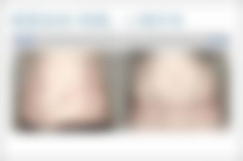 山西人民医院皮肤科怎么样特色项目及技术优势