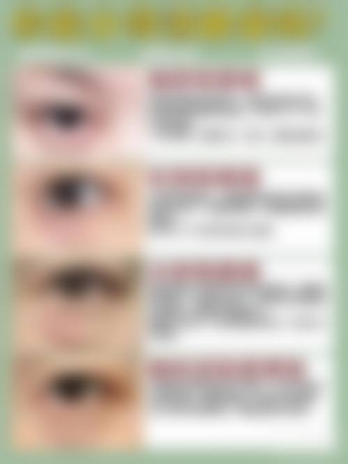 石狮栢丽医疗美容整形医院怎么样价格收费