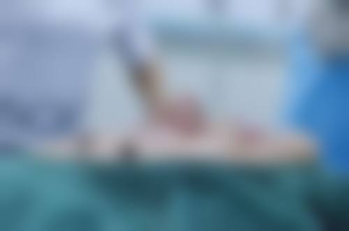 朱昭炜医生的成功实例见证实力