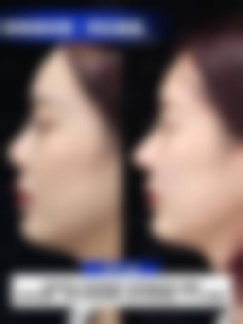 纪影畅医生的个性化方案优势