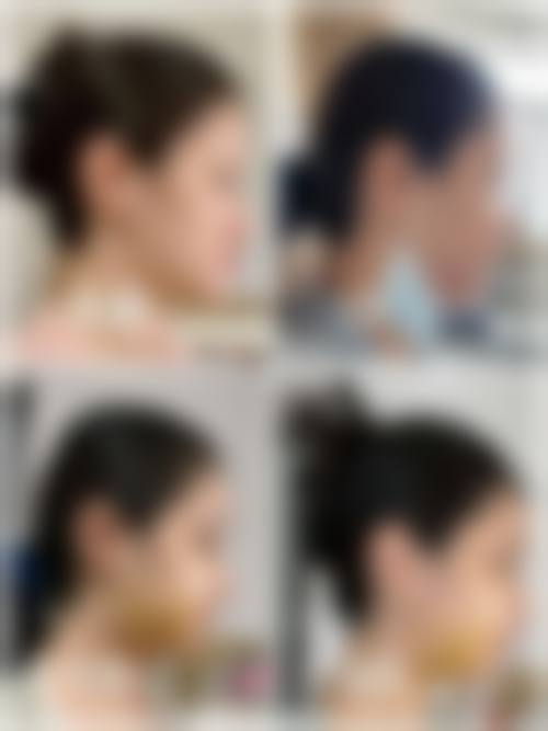 齐金杰医生的技术特色与优势