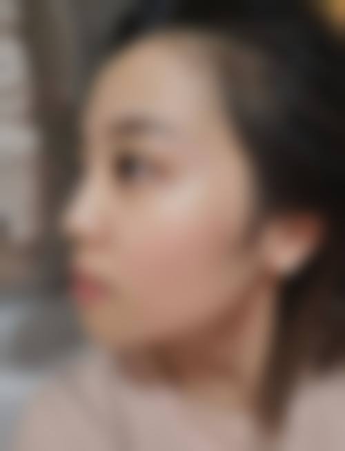 黄山百魅生医疗美容门诊部怎么样求美者反馈