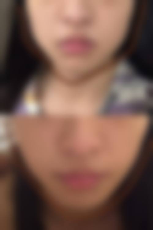 杨燕祥医生：优惠价格服务大众