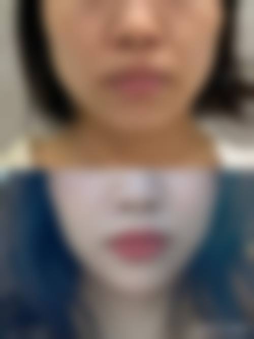 李艳莲医生的成功实例