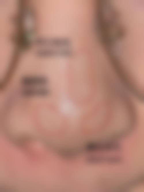 韩国CDU清潭优整形外科皮肤科怎么样来院路线