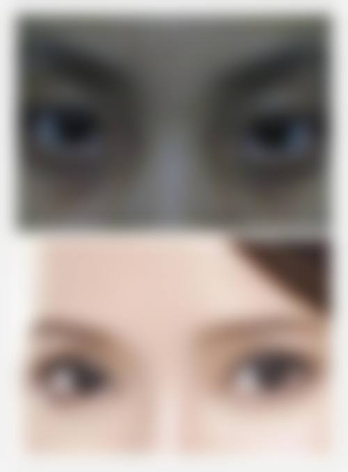 广州美诗沁整形医院怎么样求美者反馈