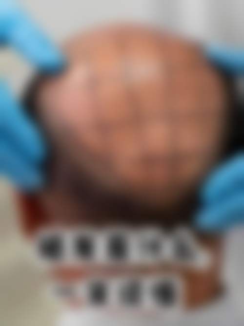 上海瑞丽诗植发医院怎么样价格收费