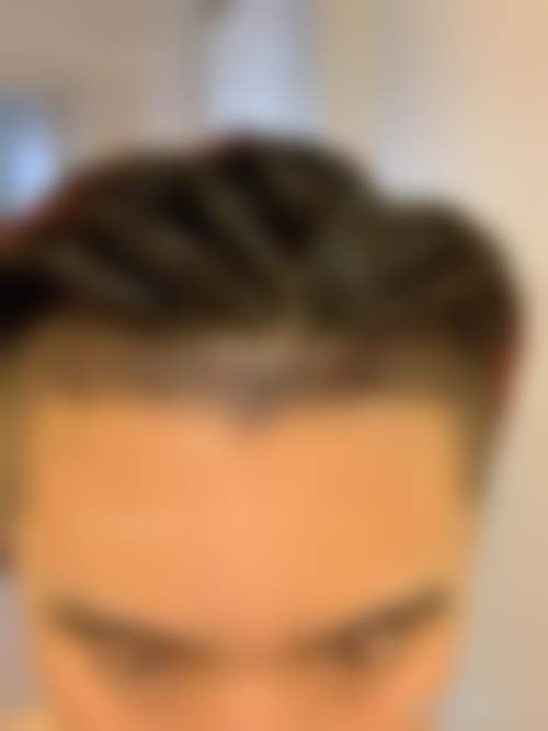 上海瑞丽诗植发医院