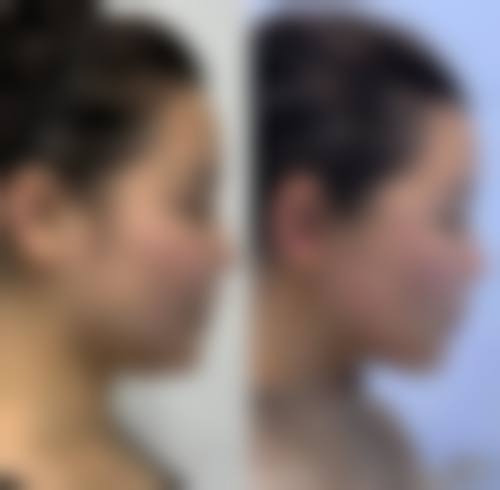 石狮栢丽医疗美容整形医院怎么样来院路线