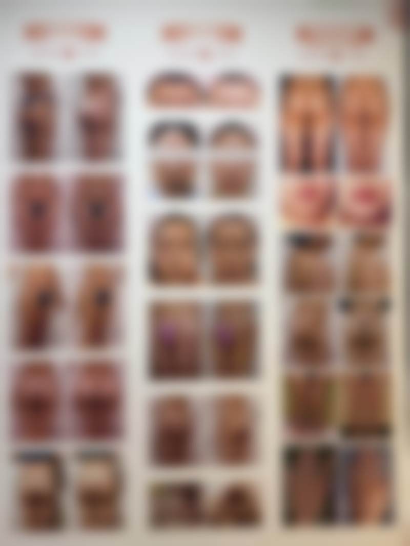 韩国宝尼达Bonita整形医院怎么样特色项目及技术优势