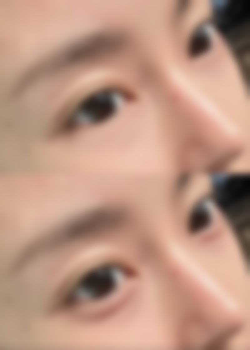 王艺颖医生擅长的美容领域