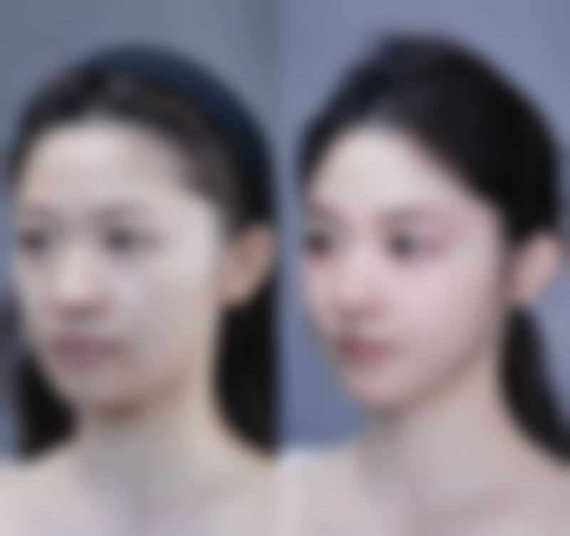 青岛雅美汇医疗美容门诊部怎么样价格收费