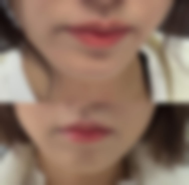 王艺颖医生的成功实例