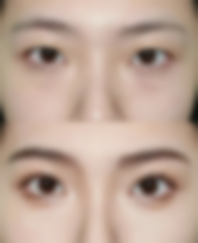 长春碧宝医疗美容门诊部怎么样特色项目及技术优势