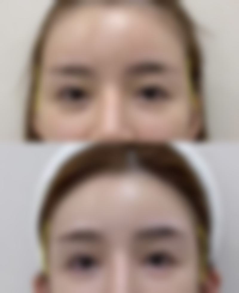 山西人民医院皮肤科怎么样价格收费